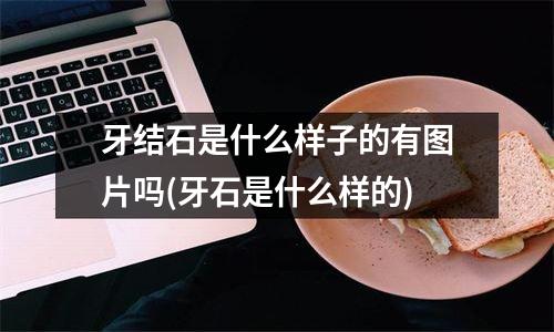 牙结石是什么样子的有图片吗(牙石是什么样的)